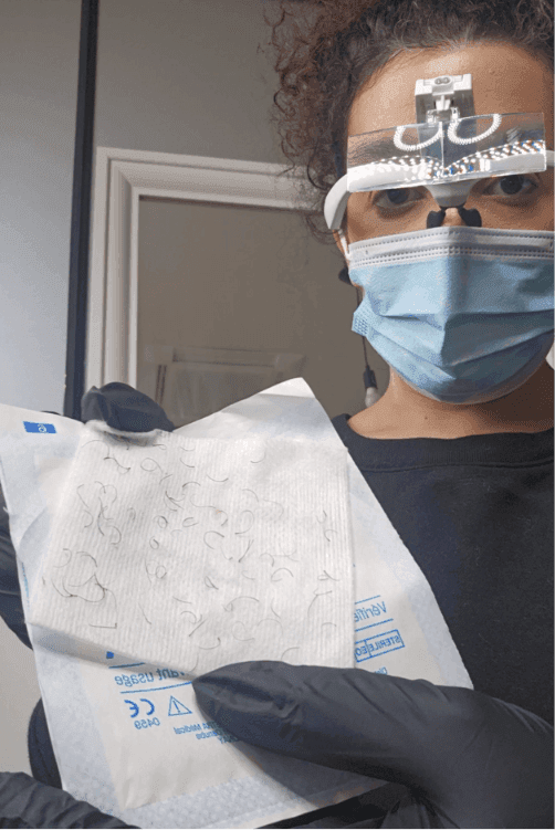 Melissa, praticienne Electraderm, en séance d'électrolyse à Saint-Denis